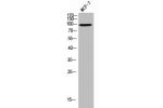 Western Blot analysis of MCF-7 cells using CD36 Polyclonal Antibody