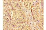 Immunohistochemistry of paraffin-embedded human adrenal gland tissue using CSB-PA006184LA01HU at dilution of 1:100