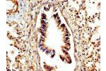 IHC image of CSB-PA006186LA01HU diluted at 1:300 and staining in paraffin-embedded human lung tissue performed on a Leica BondTM system. After dewaxing and hydration, antigen retrieval was mediated by high pressure in a citrate buffer (pH 6.0). Section wa