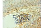 Immunohistochemistry of paraffin-embedded human tonsil using CSB-PA006190ESR2HU at dilution 1:100