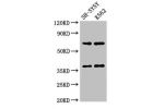 Western Blot<br />
Positive WB detected in:SH-SY5Y whole cell lysate,K562 whole cell lysate<br />
All lanes:CTSH antibody at 2.7