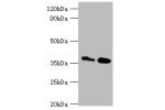 Western blot<br />
All lanes:CTSK antibody at 8ug/ml<br />
Lane 1:MCF-7 whole cell lysate<br />
Lane 2:Rat brain tissue<br />
Secondary<br />
Goat polyclonal to rabbit at 1/10000 dilution<br />
Predicted band size: 37kDa<br />
Observed band size: 37kDa<br