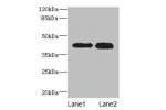Western blot<br />
All lanes: CTSL antibody at 12ug/ml<br />
Lane 1 : A549 whole cell lysate<br />
Lane 2 : HepG-2 whole cell lysate<br />
Secondary<br />
Goat polyclonal to Rabbit IgG at 1/10000 dilution<br />
Predicted band size: 37 kDa<br />
Observed b
