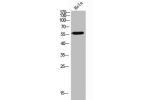 Western Blot analysis of Hela cells using CD39 Polyclonal Antibody