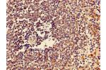 Immunohistochemistry of paraffin-embedded human spleen tissue using CSB-PA006206LA01HU at dilution of 1:100