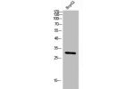 Western Blot analysis of HEPG2 cells using CD66c/d Polyclonal Antibody