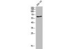 Western Blot analysis of 293-UV cells using CD96 Polyclonal Antibody