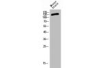 Western Blot analysis of MOUSE-BRAIN cells using CD101 Polyclonal Antibody