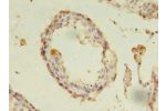 Immunohistochemistry of paraffin-embedded human testis tissue using CSB-PA006237LA01HU at dilution of 1:100