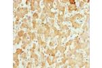 Immunohistochemistry of paraffin-embedded human liver tissue using CSB-PA006244ESR1HU at dilution 1:100