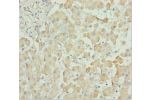 Immunohistochemistry of paraffin-embedded human liver tissue using CSB-PA006244ESR2HU at dilution 1:100