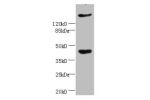 Western blot<br />
All lanes:CXCR4 antibody at 2ug/ml+Hela cells<br />
Secondary<br />
Goat polyclonal to rabbit at 1/10000 dilution<br />
Predicted band size: 40,41 kDa<br />
Observed band size: 40 kDa<br />