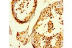 Immunohistochemistry of paraffin-embedded human testis tissue using CSB-PA006258LA01HU at dilution of 1:100