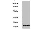 Western blot<br />
All lanes: AP-2 complex subunit mu antibody at 2ug/ml<br />
Lane 1 : EC109 whole cell lysate<br />
Lane 2 : 293T whole cell lysate<br />
Secondary<br />
Goat polyclonal to Rabbit IgG at 1/15000 dilution<br />
Predicted band size: 48 kDa