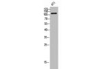 Western Blot analysis of 4T1 cells using Flt3 Polyclonal Antibody
