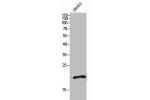 Western Blot analysis of SKOV3 cells using BST-2 Polyclonal Antibody