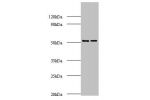 Western blot<br />
All lanes: AP-2 complex subunit mu polyclonal Antibody at 2ug/ml<br />
Lane 1:mouse brain tissue<br />
Lane 2:Rat brain tissue<br />
Secondary<br />
Goat polyclonal to Rabbit IgG at 1/10000 dilution<br />
Predicted band size: 50kDa<br /
