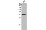 Western Blot analysis of PC12 cells using CD298 Polyclonal Antibody