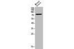 Western Blot analysis of MOUSE-BRAIN cells using CD180 Polyclonal Antibody