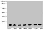 Western blot<br />
All lanes: CYB5B antibody at 0.8ug/ml<br />
Lane 1 : HepG-2 whole cell lysate<br />
Lane 2 : Mouse liver tissue<br />
Lane 3 : Mouse heart tissue<br />
Lane 4 : Hela whole cell lysate<br />
Lane 5 : U87 whole cell lysate<br />
Lane 6 : 