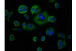 Immunofluorescence staining of MCF-7 cells with CSB-PA006323LA01HU at 1:66,counter-stained with DAPI. The cells were fixed in 4% formaldehyde, permeabilized using 0.2% Triton X-100 and blocked in 10% normal Goat Serum. The cells were then incubated with t
