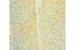 Immunohistochemistry of paraffin-embedded human tonsil tissue using CSB-PA006325LA01HU at dilution 1:100