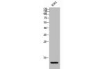Western Blot analysis of K562 cells using MIP-1b Polyclonal Antibody