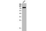Western Blot analysis of K562 cells using P-cadherin Polyclonal Antibody