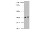 All lanes: ATP synthase subunit delta, mitochondrial antibody at 2ug/ml<br />
Lane 1 : EC109 whole cell lysate<br />
Lane 2 : 293T whole cell lysate<br />
Secondary<br />
Goat polyclonal to Rabbit IgG at 1/15000 dilution<br />
Predicted band size: 60,55,5