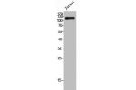 Western Blot analysis of Jurkat cells using VE-Cadherin Polyclonal Antibody