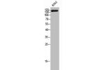Western Blot analysis of K562 cells using CAF-1 p150 Polyclonal Antibody