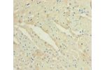 Immunohistochemistry of paraffin-embedded human heart tissue using CSB-PA006376LA01HU at dilution 1:100