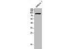 Western Blot analysis of RAW264.7 cells using Cadherin-8 Polyclonal Antibody