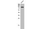 Western Blot analysis of Jurkat cells using OB-cadherin Polyclonal Antibody