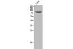 Western Blot analysis of LOVO cells using T-cadherin Polyclonal Antibody