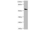 Western blot<br />
All lanes: Cholesterol side-chain cleavage enzyme, mitochondrial antibody at 2ug/ml+rat adrenal gland<br />
Secondary<br />
Goat polyclonal to rabbit at 1/10000 dilution<br />
Predicted band size: 61,43 kDa<br />
Observed band size: 60 