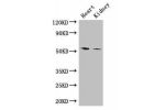 Western Blot<br />
Positive WB detected in:Mouse heart tissue,Mouse kidney tissue<br />
All lanes: CYP11B1 antibody at 3ug/ml<br />
Secondary<br />
Goat polyclonal to rabbit IgG at 1/50000 dilution<br />
Predicted band size: 58,50 kDa<br />
Observed band 
