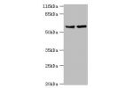 Western blot<br />
All lanes:Steroid 17-alpha-hydroxylase/17,20 lyase antibody at 2ug/ml<br />
Lane 1:Hela whole cell lysate<br />
Lane 2:A549 whole cell lysate<br />
Secondary<br />
Goat polyclonal to rabbit at 1/10000 dilution<br />
Predicted band size: