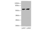 Western blot<br />
All lanes: Steroid 17-alpha-hydroxylase/17,20 lyase antibody at 12ug/ml<br />
Lane 1 : Hela whole cell lysate<br />
Lane 2 : A549 whole cell lysate<br />
Secondary<br />
Goat polyclonal to Rabbit IgG at 1/10000 dilution<br />
Predicted 