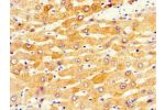 Immunohistochemistry of paraffin-embedded human liver tissue using CSB-PA006396LA01HU at dilution of 1:100