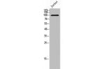 Western Blot analysis of Jurkat cells using LI-cadherin Polyclonal Antibody