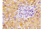 Immunohistochemistry of paraffin-embedded human liver tissue using CSB-PA006414LA01HU at dilution of 1:100