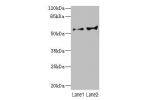 Western blot<br />
All lanes: CYP2C18 antibody at 5.98ug/ml<br />
Lane 1 : HL60 whole cell lysate<br />
Lane 2 : 293T whole cell lysate<br />
Secondary<br />
Goat polyclonal to Rabbit IgG at 1/10000 dilution<br />
Predicted band size: 56,49 kDa<br />
Obse