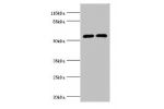 Western blot<br />
All lanes:CYP2E1 antibody at 12ug/ml<br />
Lane 1:Jurkat whole cell lysate<br />
Lane 2:mouse liver tissue<br />
Secondary<br />
Goat polyclonal to rabbit at 1/10000 dilution<br />
Predicted band size: 57kDa<br />
Observed band size: 57