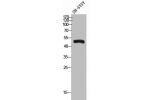 Western Blot analysis of SH-SY5Y cells using Angptl7 Polyclonal Antibody