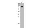 Western Blot analysis of COLO cells using CNK1 Polyclonal Antibody