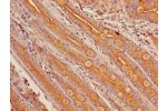 Immunohistochemistry of paraffin-embedded human small intestine tissue using CSB-PA006439LA01HU at dilution of 1:100