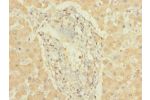 Immunohistochemistry of paraffin-embedded human liver tissue CSB-PA006444LA01HU at dilution 1:100