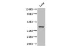 Western Blot<br />
Positive WB detected in:Mouse lung tissue<br />
All lanes: CYSLTR1 antibody at 3ug/ml<br />
Secondary<br />
Goat polyclonal to rabbit IgG at 1/50000 dilution<br />
Predicted band size: 39 kDa<br />
Observed band size: 39 kDa<br />
