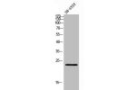 Western Blot analysis of SH-SY5Y cells using CDKN3 Polyclonal Antibody